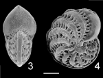 Elphidium advenum botaniense Elphidium advenum botaniense