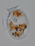 Dinophysis ovum