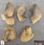 Chondrilla linnaei preserved holotype Chondrilla linnaei preserved holotype