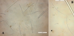 Clathria gradalis spicules Clathria gradalis spicules