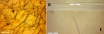 Clathria toxistricta skeleton and spicules Clathria toxistricta skeleton and spicules