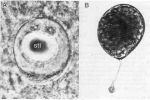 Platyhelminthes (flatworms)