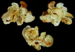 Xenophora (Xenophora) crispa Xenophora (Xenophora) crispa