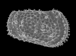Acanthocythereis dunelmensis