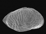 Cytheropteron dimlingtonensis