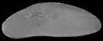 Paracytherois sp.