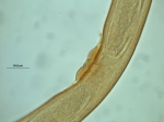 Calomicrolaimus compridus, copulatory plug Calomicrolaimus compridus, copulatory plug