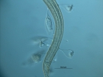 Desmodorella sp.,with ciliate hitch-hikers Desmodorella sp.,with ciliate hitch-hikers