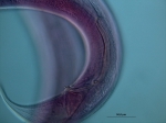Dorylaimopsis sp., spicules Dorylaimopsis sp., spicules