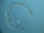 Metadasynemella sp. Metadasynemella sp.