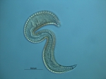 Metepsilonema sp. Metepsilonema sp.