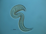 Metepsilonema sp. Metepsilonema sp.