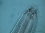 Paramesacanthion sp., detail head Paramesacanthion sp., detail head