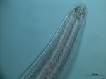 Paramesacanthion sp. Paramesacanthion sp.