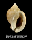 Semicassis undulata
