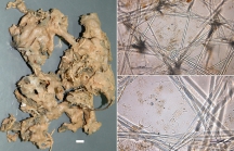 Mycale (Zygomycale) sierraleonensis habit and skeleton