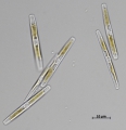 Chromista - Bacillariophyceae (diatoms)