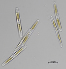 Nitzschia bizertensis, light micrograph