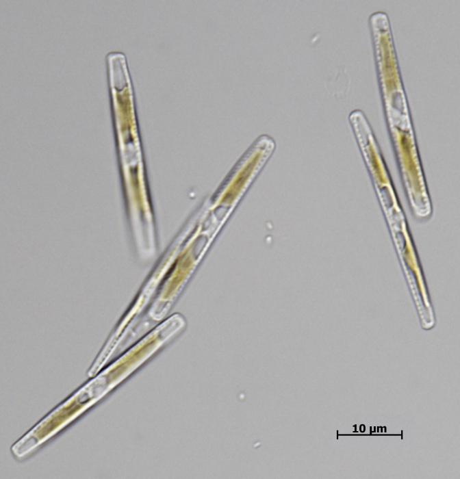 Nitzschia bizertensis, light micrograph