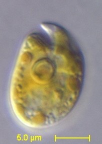 Amphidinium carterae Amphidinium carterae