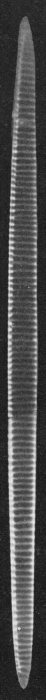 LM of valve from type locality LM of valve from type locality