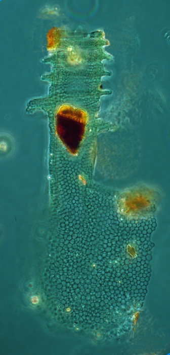 Climacocylis scalaria Brandt, 1906 Climacocylis scalaria Brandt, 1906