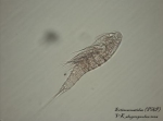 Ectinosomatidae