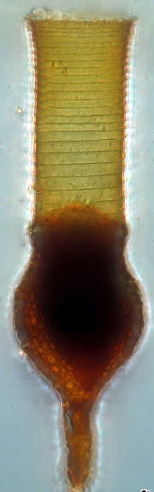Codonellopsis orthoceras