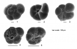 Chromista - Foraminifera (foraminifers)