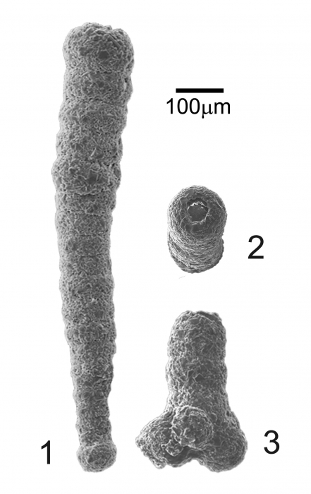 Polysaccammina hyperhalina Medioli, Scott and Petrucci, 1983