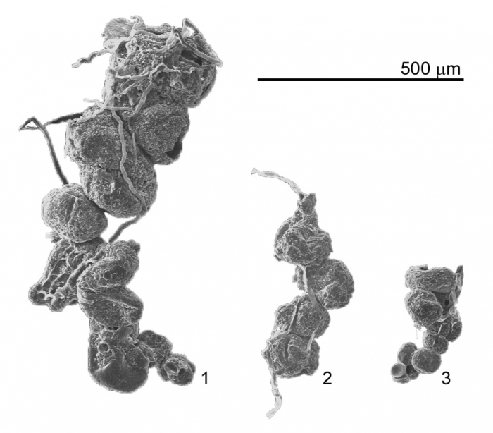 Polysaccammina ipohalina Scott, 1976