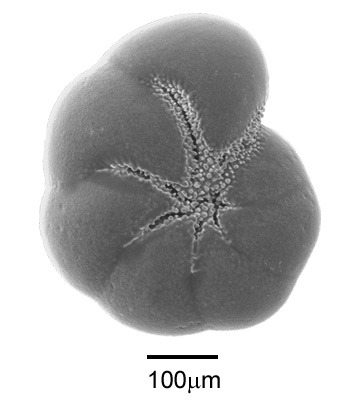 Haynesina germanica (Ehrenberg, 1840)