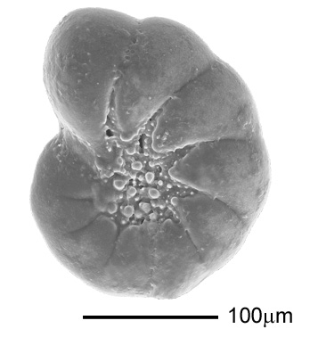 Haynesina depressula (Walker & Jacob, 1798)