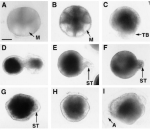 Tailless Embryos of Mogula bleizi