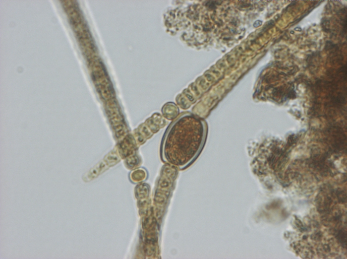 Anabaena bergii Ostenfeld 1908