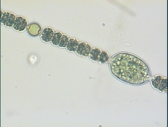 Anabaena planctonica