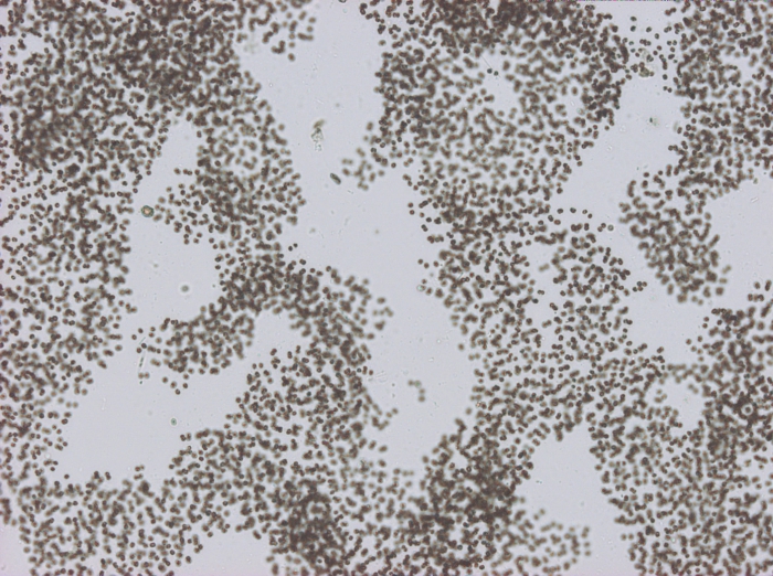 Microcystis aeruginosa 100x Microcystis aeruginosa 100x