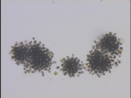 Microcystis botrys