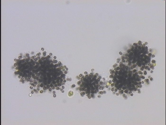 Microcystis botrys Microcystis botrys