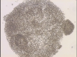 Microcystis flos-aquae
