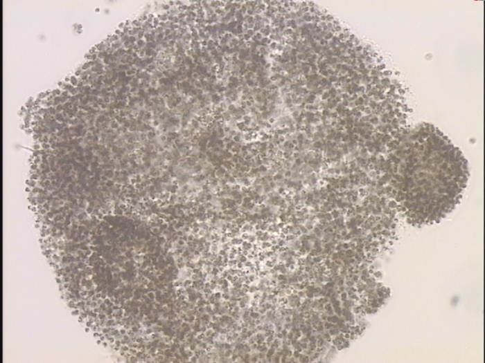 Microcystis flos-aquae Microcystis flos-aquae