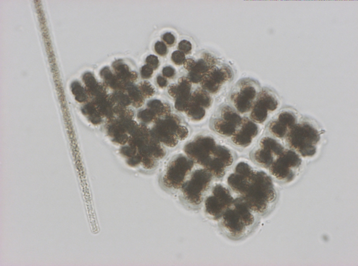 Microcystis viridis 400x Microcystis viridis 400x