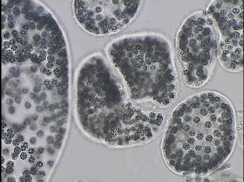 Microcystis wesenbergii