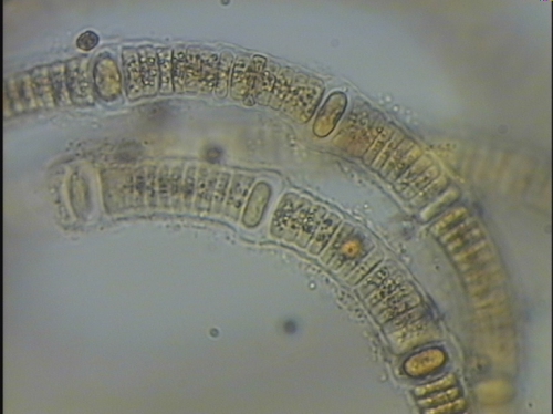 Nodularia spumigena