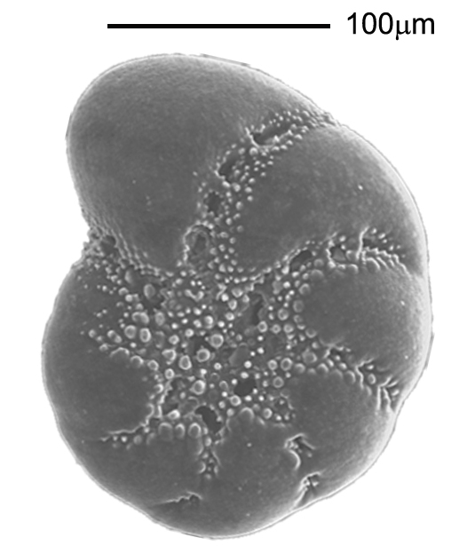 Cribroelphidium excavatum (Terquem, 1875) Cribroelphidium excavatum (Terquem, 1875)