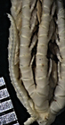 Antedon angustipinna Carpenter, 1888