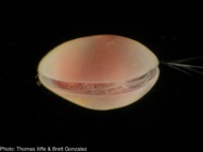 Deeveya sp. (Ostracoda: Halocypridae: Deeveyinae) from an anchialine cave on Abaco, Bahamas.