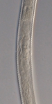 Paratype female midbody of Antomicron lorenzeni