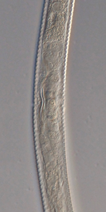 Paratype female midbody of Antomicron lorenzeni