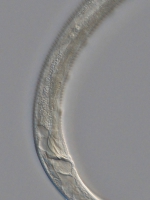 Holotype male posterior end of Antomicron quindecimpapillatus